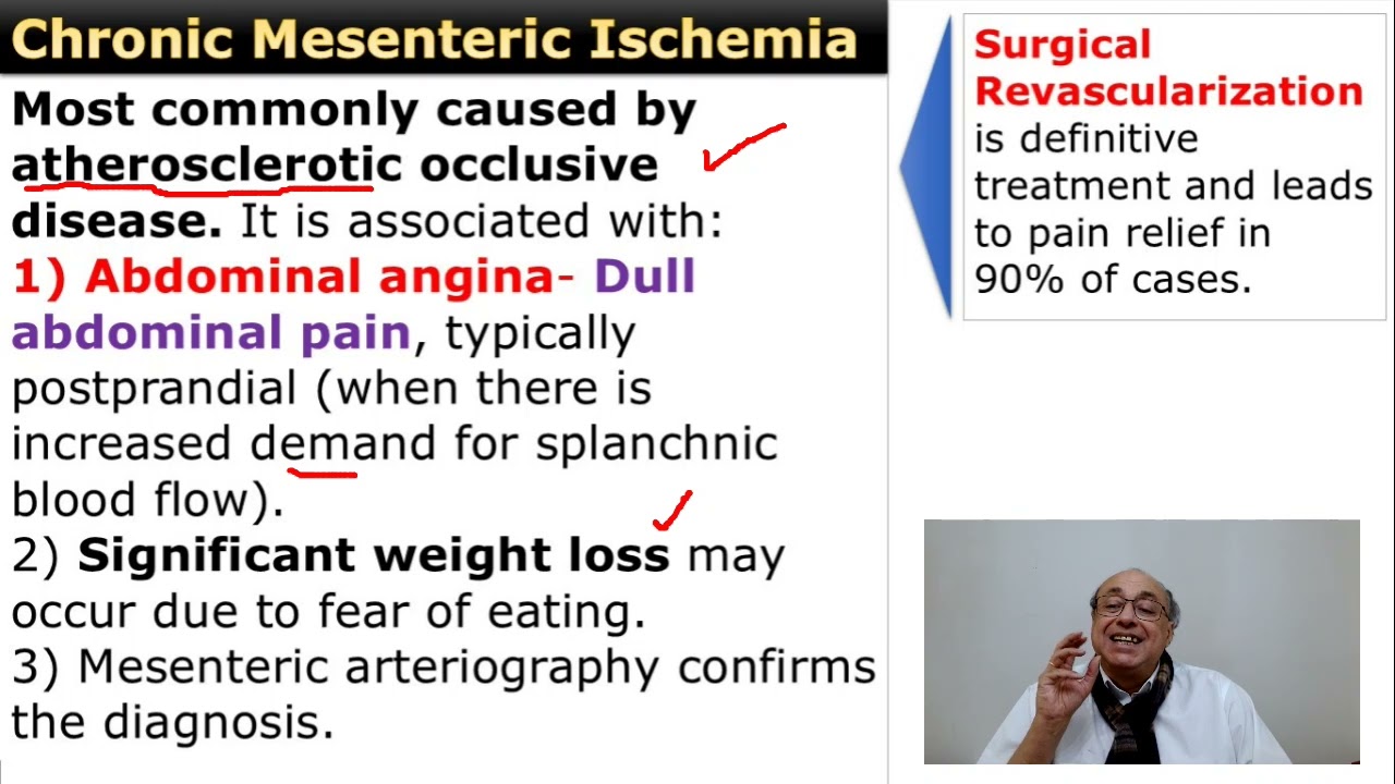 Chronic Mesenteric Ischemia