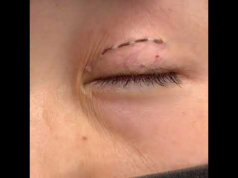 Ужас: Жительница улуса стала жертвой операции сангапури Ужас: Жительница улуса стала жертвой операции сангапури
