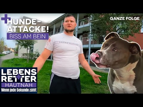 Brutaler Hundekampf - Mann geht dazwischen & ist blutüberströmt | Lebensretter hautnah | SAT.1