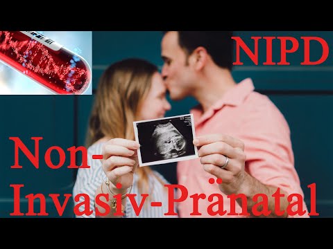 Was du unbedingt über den Nicht Invasiven Pränatal Test wissen solltest