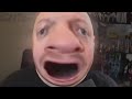 YTP Higginbottom Heels His Baby Face
