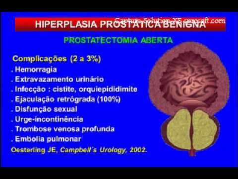 Prostamol erezione