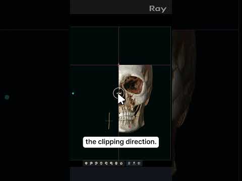 SMARTDent : 5D Tutorial #2-2. Clipping in 3D view
