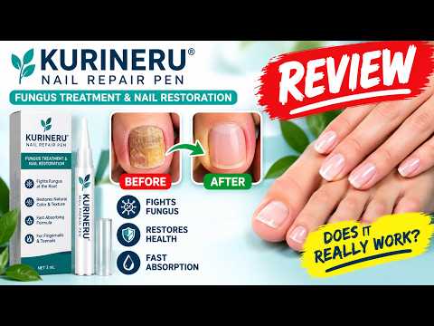 🔥 KURINERU NAIL REPAIR PEN NAIL FUNGUS REVIEWS – DOES IT REALLY WORK? BEFORE & AFTER RESULTS