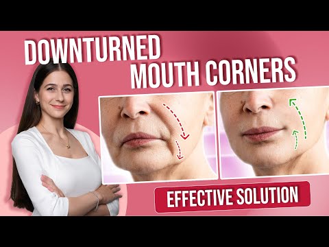 Remedies for skin tightening and face lift #downturned mouth corners