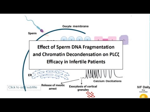 Sperm DNA Fragmentation And PLCz