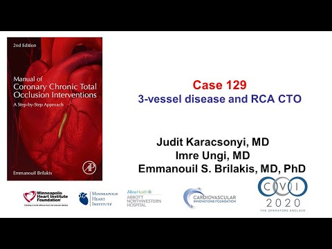 Case 129: Manual of CTO Interventions - 3 vessel disease + RCA CTO