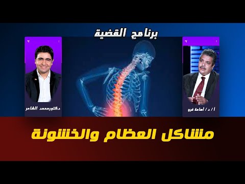 مشاكل العظام برنامج القضية دكتور محمد الشاعر مع أ د أسامة فرج