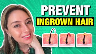 4 Tips & Tricks to Prevent Ingrown Hair! | Dr. Shereene Idriss