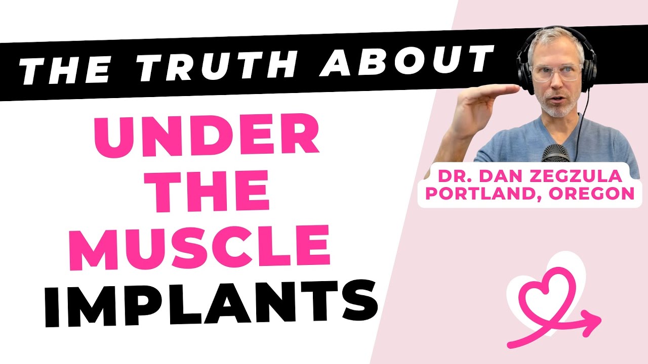 The truth about under-the-muscle breast implants [Dan Zegzula, MD, Portland]