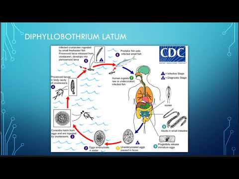 Diphyllobothriasis etiológia patogenezise, Dr. Diag - Diphyllobothrium latum infestatio