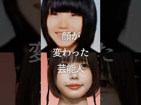 Celebrities whose faces have changed Part 2 #GalChan #Celebrities #PlasticSurgery