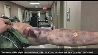 Prophecy Alert: &quot;Scorpion Locust&quot; Revelation Plague Bites Man In Arizona?