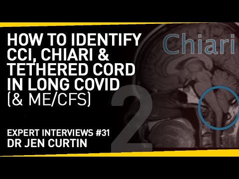 Do you have CCI, Chiari or Tethered Cord? The Symptoms to Look Out For with Long Covid or ME/CFS