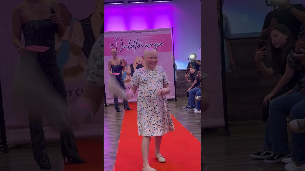 “these beautiful things that i got” aka alopeciaaaaa🫶🏼💘 #baldisbeautiful #baldtourage