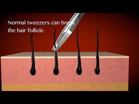 Why Regine Tweezers Stand Out From The Rest! The World’s Best Tweezers • Diamond Slant Tip Tweezer