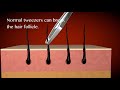 Best Tweezers For Fine Eyebrow Hair