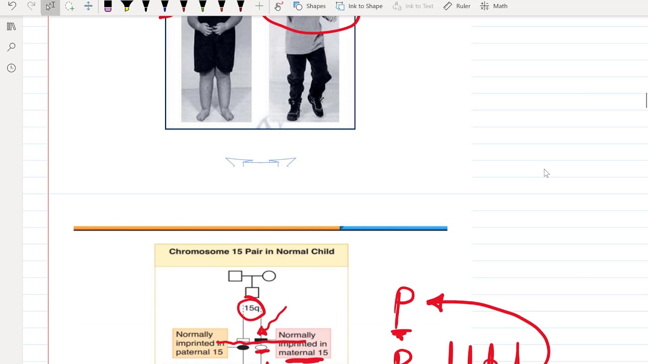 3. Genetics For USMLE Step 1 - (Free trial course in Description Below)