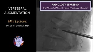 VERTEBRAL AUGMENTATION: Mini Lecture, Dr. John Guynan, MD