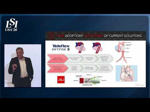 Manish Wadhwa, SummaCor - Pulsatile heart-assist pump for temporary support | LSI USA '26