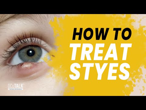 How to treat a stye with Dr. Vazhappilly