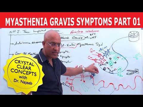Myasthenia Gravis | Symptoms and Treatment | Part 1🩺