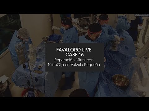 Favaloro Live Case N° 16 - Reparación Mitral con MitraClip en Válvula Pequeña