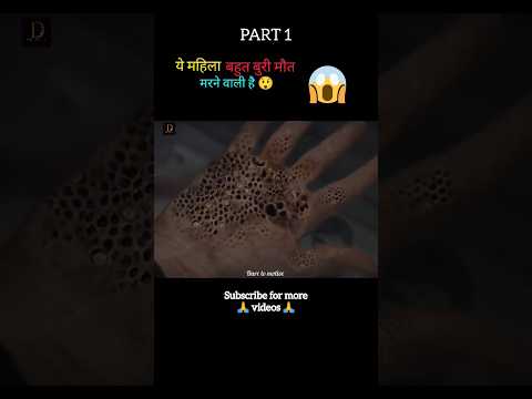 Trypophobia full movie explain in Hindi/Urdu part 1 😱 