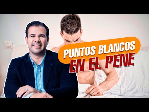 Puntos Blancos en el PENE ¿Es grave?
