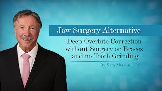 Deep Overbite Correction without Surgery or Braces and no Tooth Grinding