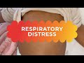Respiratory Distress In Children Fast Noisy Breathing