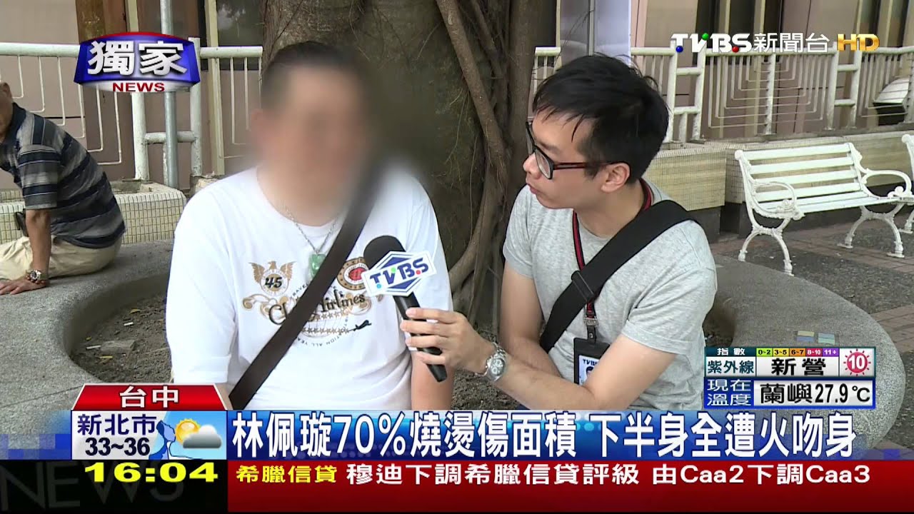 獨家/2013城市小姐林珮璇遭火吻 70%重傷