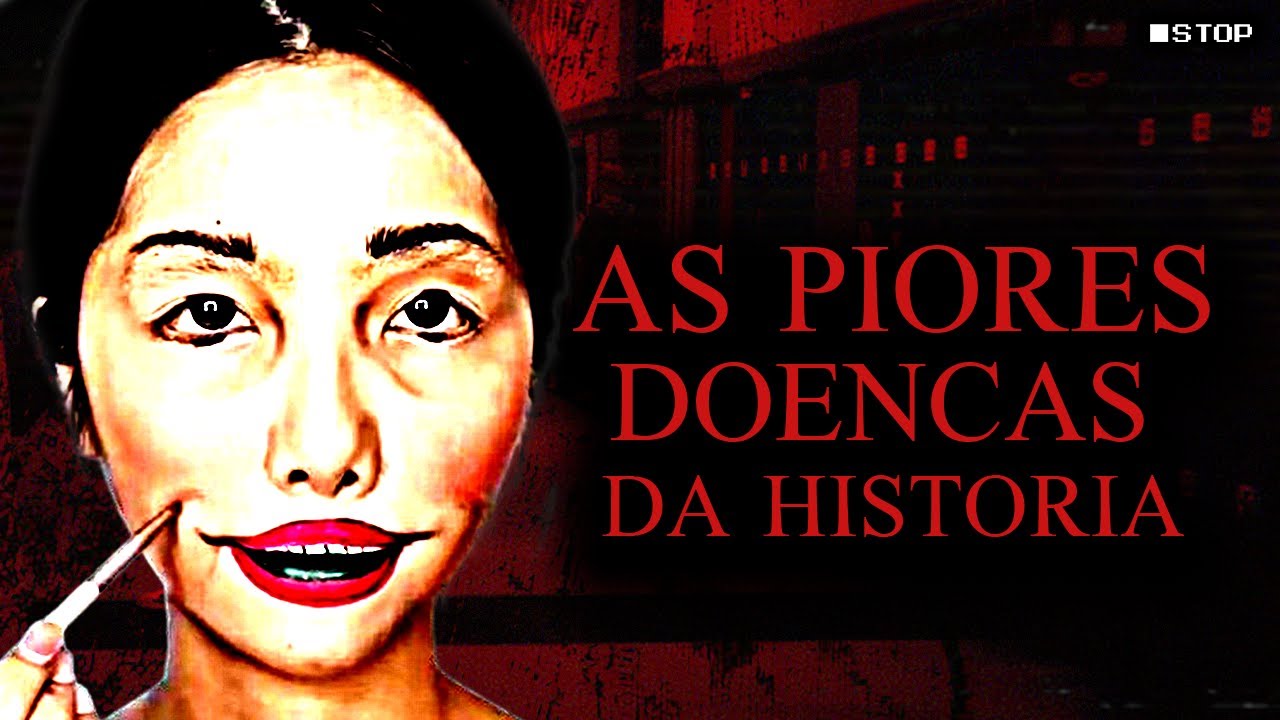 As Piores Doenças Da Humanidade - Casos Raros e Misteriosos