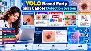YOLO-Based Early Skin Cancer Detection System Using Deep Learning with Python