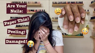 Acrylics damaged my nails! How to bring damaged Nails back to health!