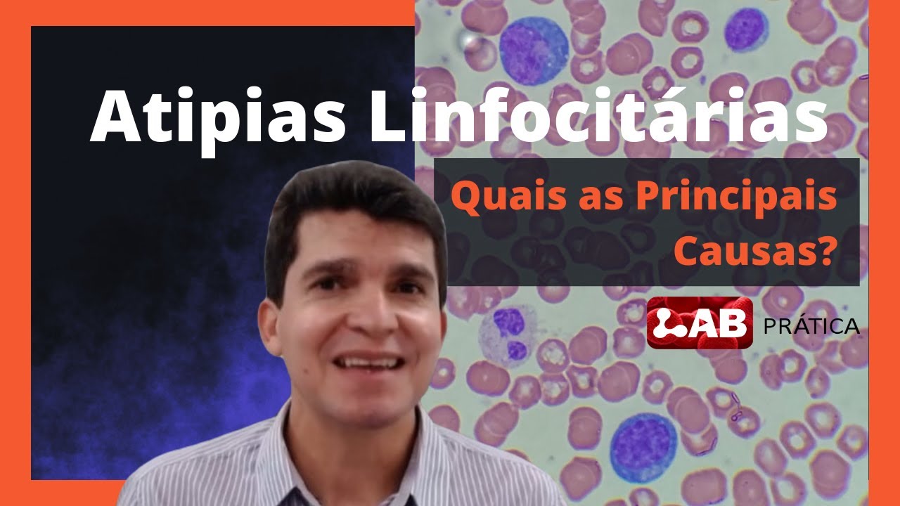 Atipias Linfocitárias - Quais as Principais Causas?
