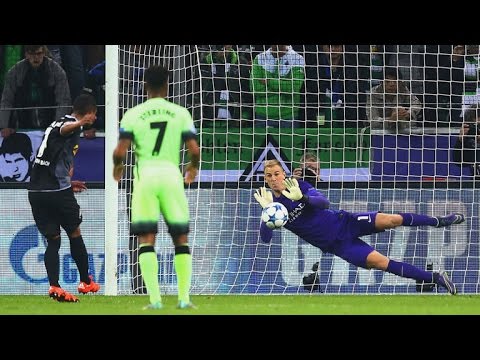 Joe Hart vs Borussia Monchengladbach