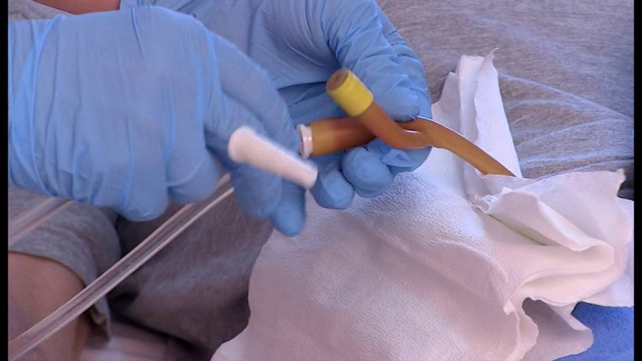 Wymiana worka na mocz