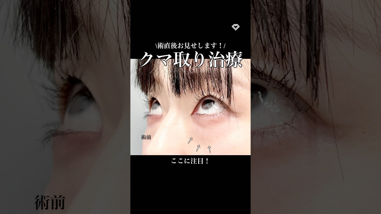 Youtubeのサムネイル