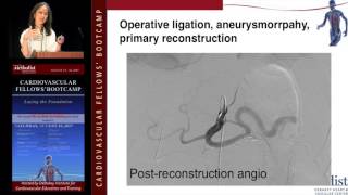 Download Lagu Management of Visceral Artery Aneurysms (Tam Huynh, MD) Thumbnail