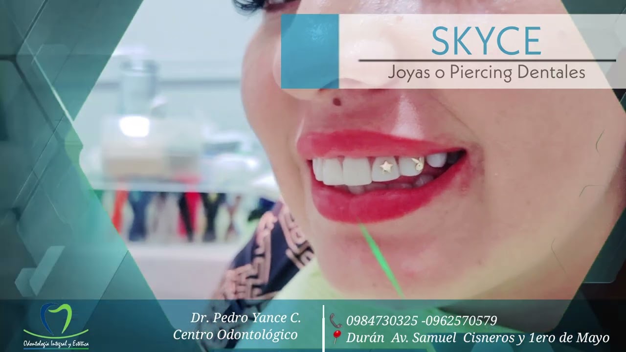 💎PIERCING DENTAL ESTETICO/BRILLANTES DENTALES / JOYAS DENTALES