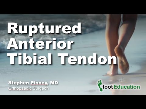 Ruptured Anterior Tibial Tendon
