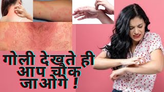 Cetnet Tablets Uses & Review गोली देखते ही आप चौक जाओगे !