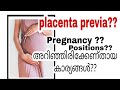 Placenta Previa during Pregnancy Malayalam, pregnancy care