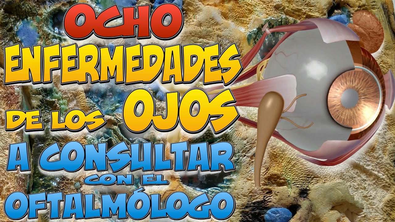 8 ENFERMEDADES de los OJOS a consultar con un OFTALMÓLOGO
