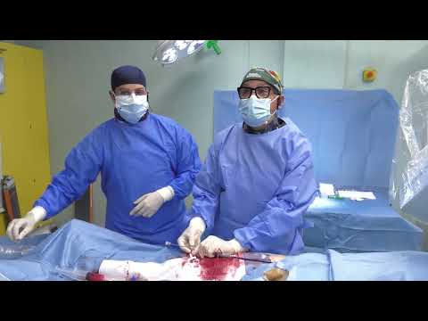 Live Case: Chiusura Percutanea Auricola Sinistra - Reparto Cardiologia P.O. Santa Maria della Pietà
