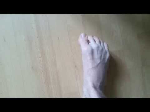 comment soigner cloque pied