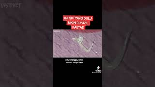 Download lagu Cacing kremi parasite manusia | Intinct mp3 Download lagu Cacing kremi parasite manusia | Intinct mp3