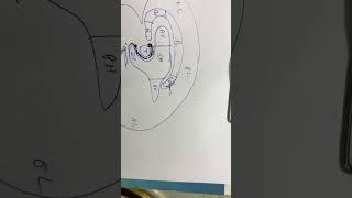 Lateral ventricle of brain