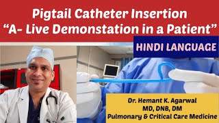 Pigtail Catheter Insertion (HINDI)- "A Live Demonstration in Pleural Effusion" @Dr. Hemant K Agarwal